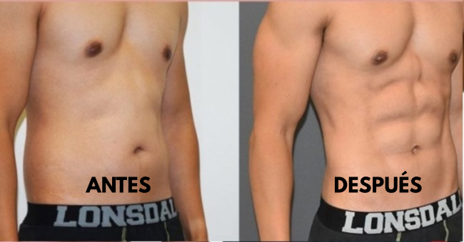 Estimulador muscular para entrenamiento de abdominales
